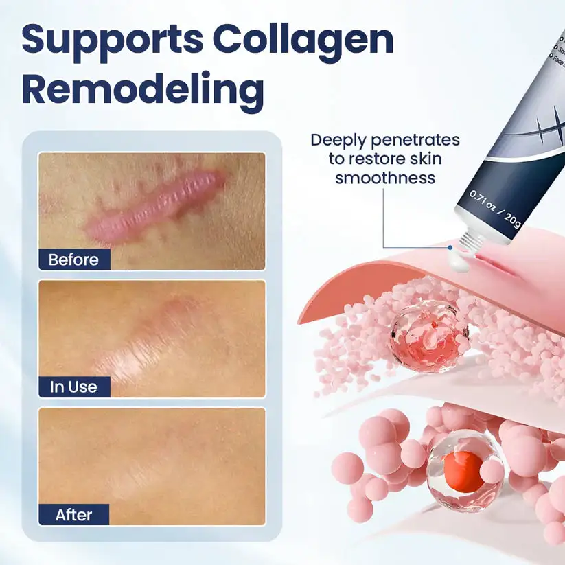 Texture Repair Gel - Image 6