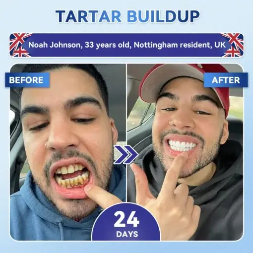 Tideglusib Fast‑Dissolving Tooth & Gum Repair Oral Strips - Image 6