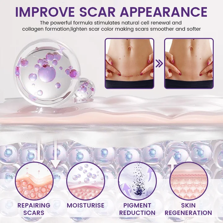 ReGenScar Stem Cell Repair Gel - Image 5