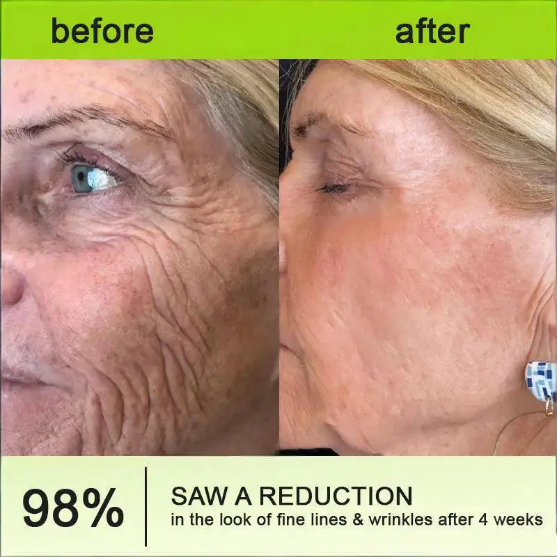 Botin & Vita-A Retinol Shot Wrinkle-Lift Tightening Cream - Image 3
