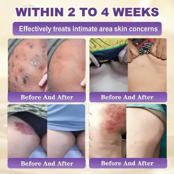 Biotin 10-in-1 Skin Restoration Cream – Last Day Promotion: 75% OFF - Image 10