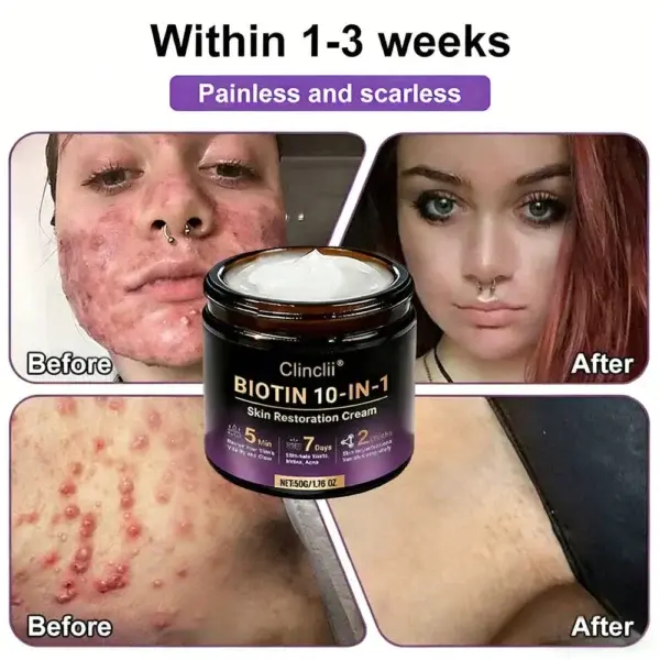 Biotin 10-in-1 Skin Restoration Cream – Last Day Promotion: 75% OFF - Image 6