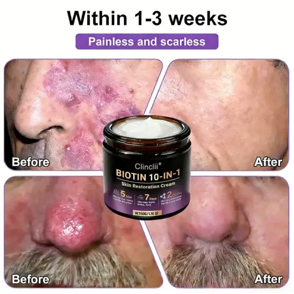 Biotin 10-in-1 Skin Restoration Cream – Last Day Promotion: 75% OFF - Image 8