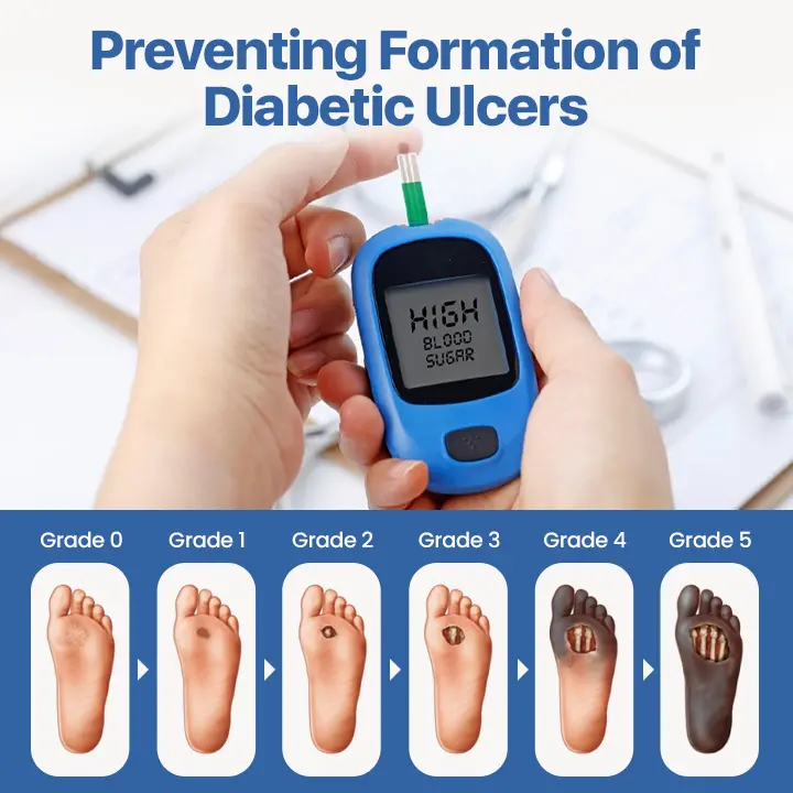 Diabetes Treatment Cream - Image 2