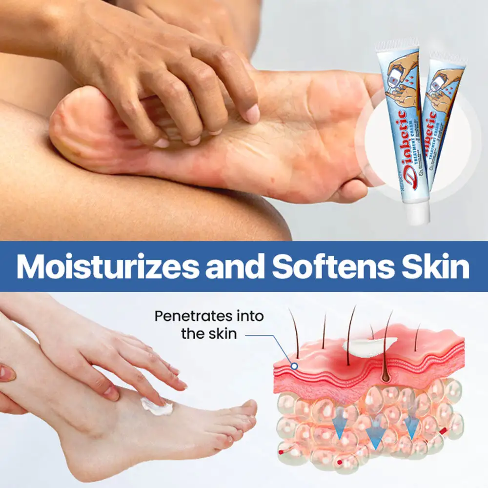 Diabetes Treatment Cream - Image 5