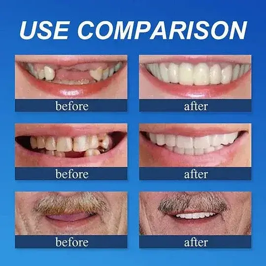 Custom-Fit Full Functional DenturesMake you more confident-Made in the USA - Image 12