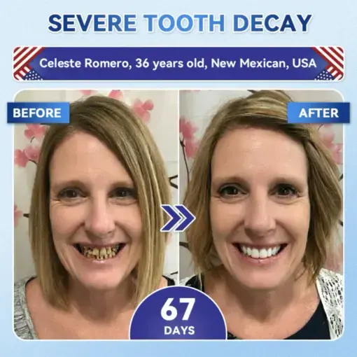Tideglusib Fast‑Dissolving Tooth & Gum Repair Oral Strips - Image 4
