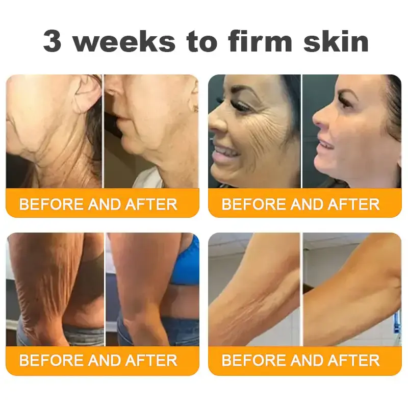 USA’s #1 Bee Venom Skin Restoration Cream - Image 10
