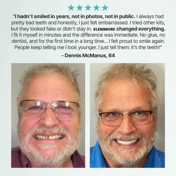 Custom-Fit Fully Functional Dentures for a More Confident Smile! - Image 12