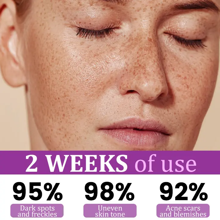 MelantraX Advanced Anti-Hyperpigmentation Essence - Image 2