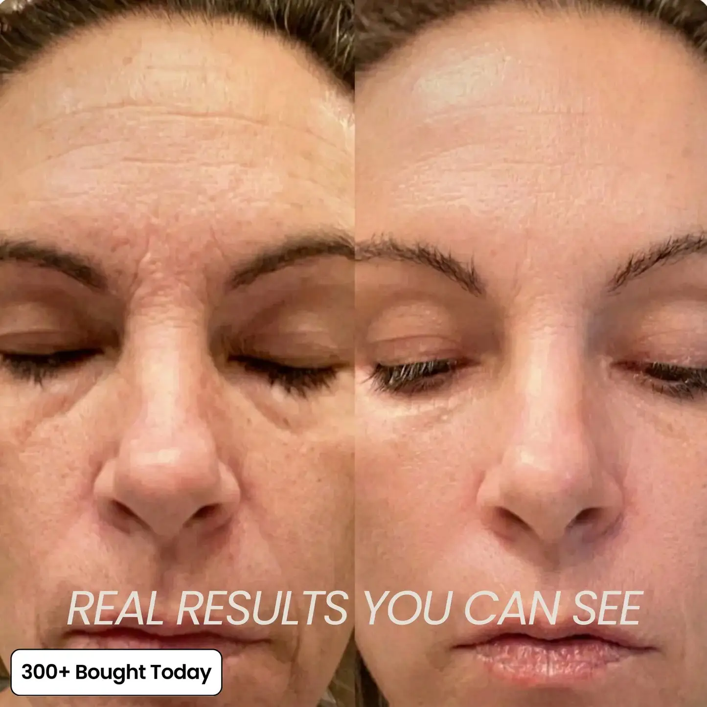 𝑺𝒍𝒊𝒎𝒐𝒍𝒚𝑺𝒌𝒊𝒏 Korean Pink CollagenVolume Multi Balm - Image 8