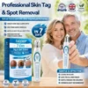 7-Day Skin Tag & Spot Eraser Painless & Scar-Free Advanced Imperfection Removal Rollerball Pen