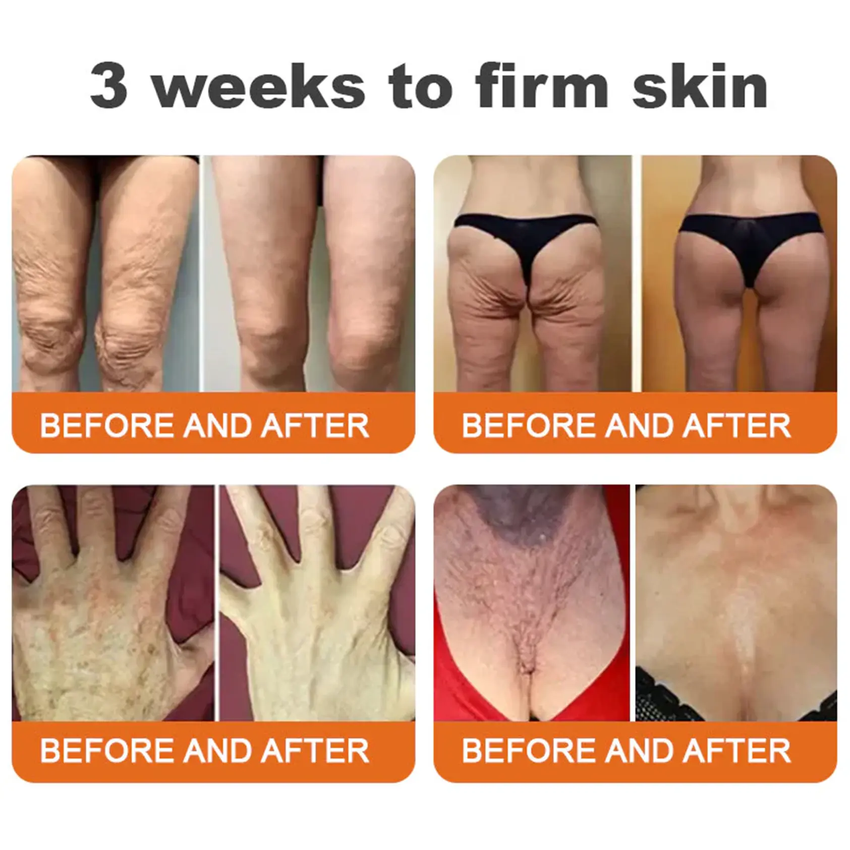 Bee venom Pro Comprehensive Cream—Tightening for Skin Types - Image 6