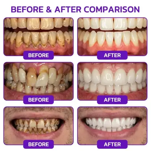 VioGum Gingivitis & Periodontal Rescue Gel - Image 3