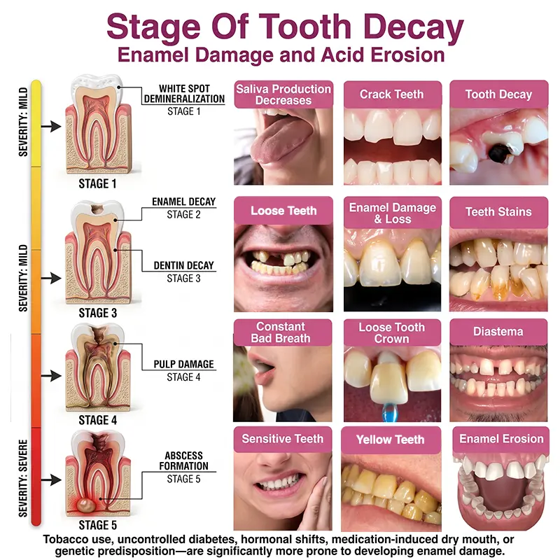 DenPerm Cavity-Repair Natural Enamel Filling Gel - Image 4